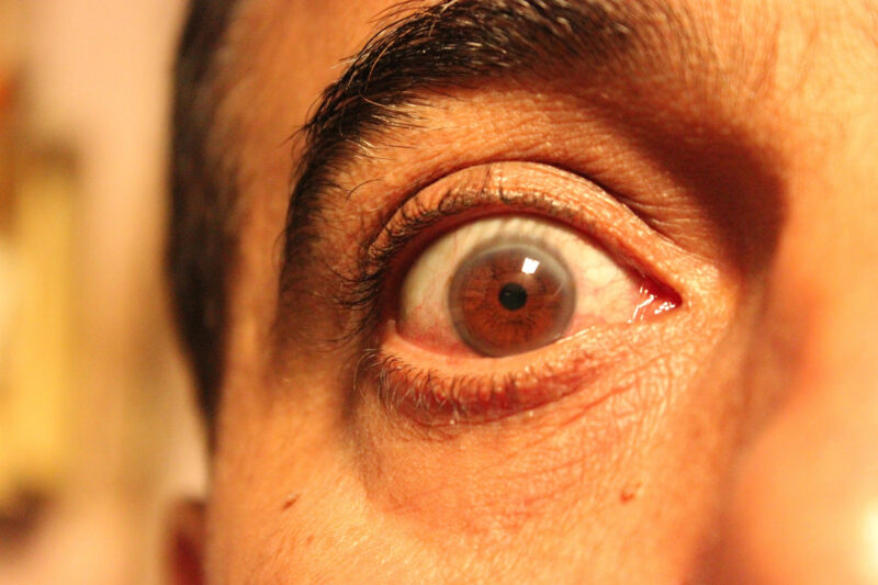 Discusting Eye NeuroTriage